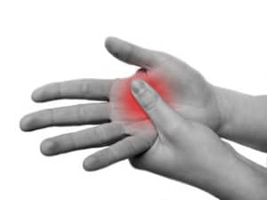 Carpal Tunnel Syndrome  Orthopedics Sports Medicine